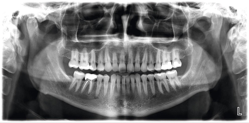 X-Ray Image