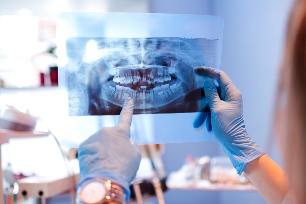 The Importance Of An Oral Cancer Screening