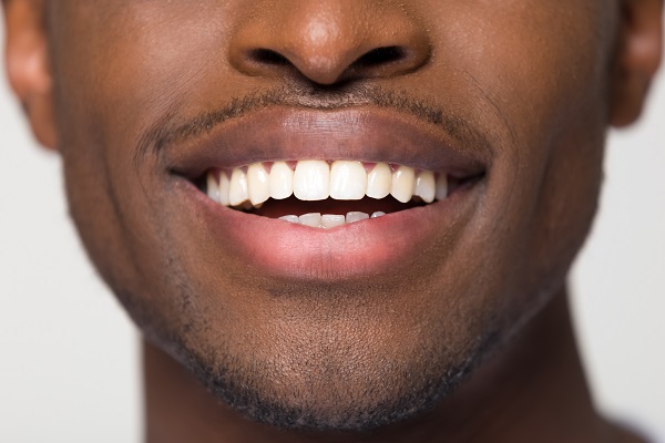 Why Is It Important To Go In For Professional In Office Teeth Whitening?